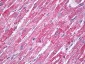 MNSOD / SOD2 Antibody